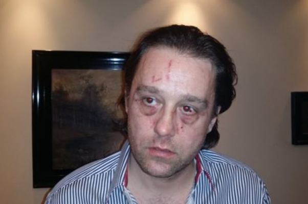 Ovo je muškarac koji je ‘izujedao’ Sergeja Trifunovića: Iznio svoju stranu priče