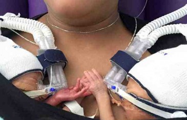 Čudo i ljepota života: Prijevremeno rođeni blizanci se drže za ručice