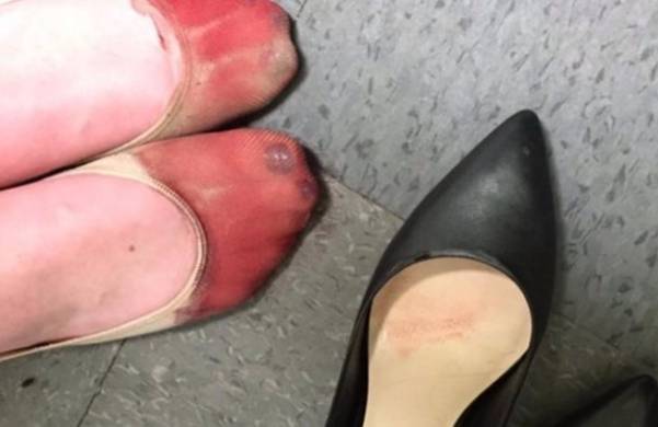 Ova fotografija konobarice sa krvavim nogama zgrozila internet