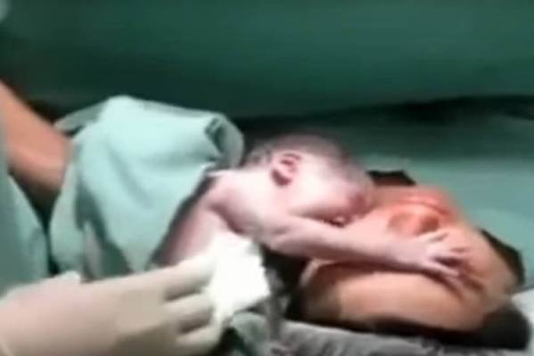 Umrla je na porođaju, a onda joj je tek rođeni sin stavio ruku na čelo: I oživela je! (VIDEO)