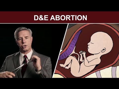 GROZNA ISTINA Pogledajte šta se sve dešava s bebom tokom abortusa (VIDEO)