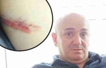 Major Hajriz Doglod nakon sukoba policije i boraca: Udaralo me i bacalo po podu sedam specijalaca!