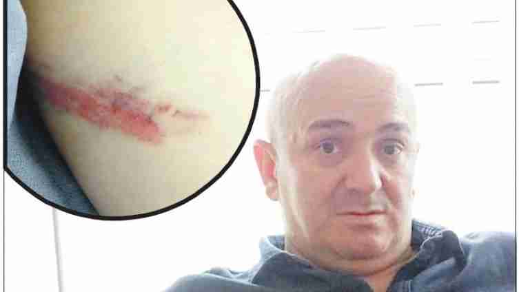 Major Hajriz Doglod nakon sukoba policije i boraca: Udaralo me i bacalo po podu sedam specijalaca!