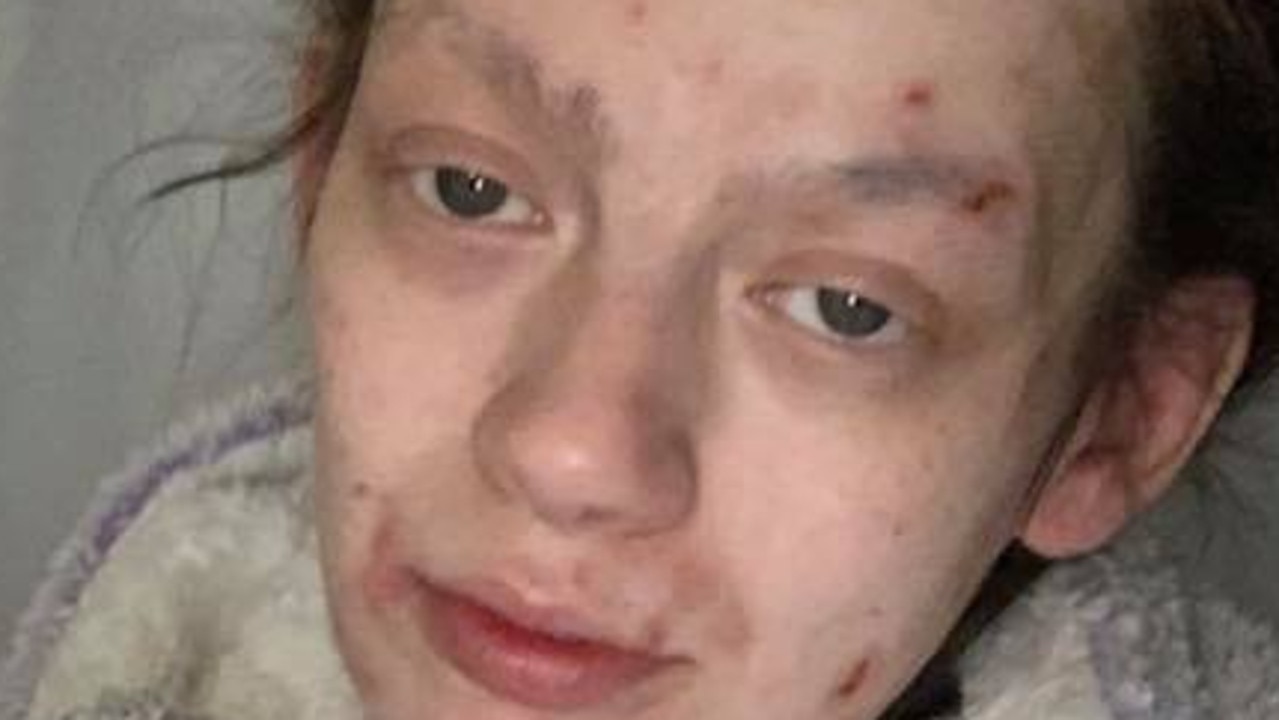 ŠOKANTNA TRANSFORMACIJA: D**girala se 2 godine, poslije 4 mjeseca bez droge izgleda kao druga osoba!