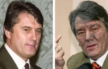 Lice mu postalo sivo, morfij primao kroz kateter: Evo kako je otrovan ukrajinski predsjednik Viktor Juščenko