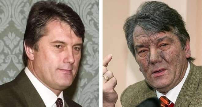 Lice mu postalo sivo, morfij primao kroz kateter: Evo kako je otrovan ukrajinski predsjednik Viktor Juščenko
