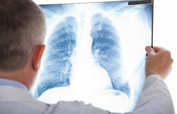 Nakon Kine i u Evropu stigao “sindrom bijelih pluća”: Otporan je na penicilin, strahuje se od nove pandemije