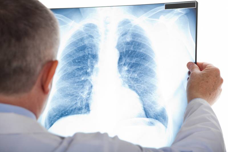 Nakon Kine i u Evropu stigao “sindrom bijelih pluća”: Otporan je na penicilin, strahuje se od nove pandemije